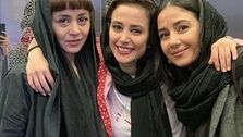 چهره باورنکردنی الناز حبیبی قبل از عمل زیبایی +عکس