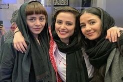چهره باورنکردنی الناز حبیبی قبل از عمل زیبایی +عکس