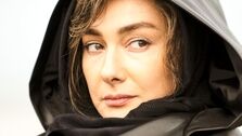 تغییر باورنکردنی هانیه توسلی بعد از عمل زیبایی | عکس هانیه توسلی