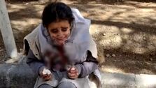 ماجرای دختر دانش‌آموز اصفهانی با صورت خون‌آلود چه بود؟+ فیلم