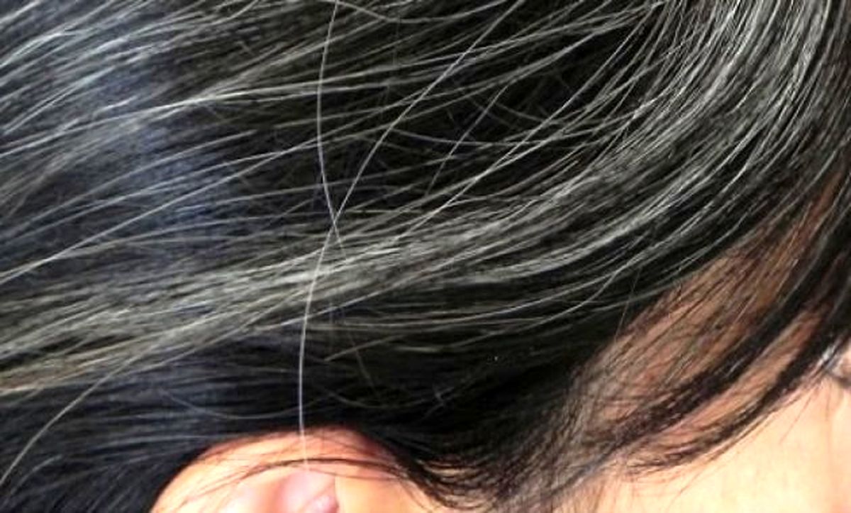 آیا موهای سفید می توانند دوباره سیاه شوند؟