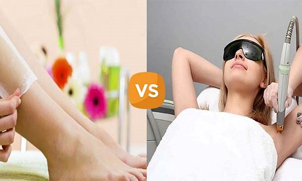 لیزر یا اپیلاسیون ، کدام روش بهتر است؟