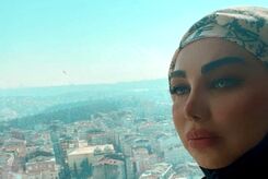 عکس جنجالی بهنوش بختیاری با دماغ قبل از عمل!!!+عکس