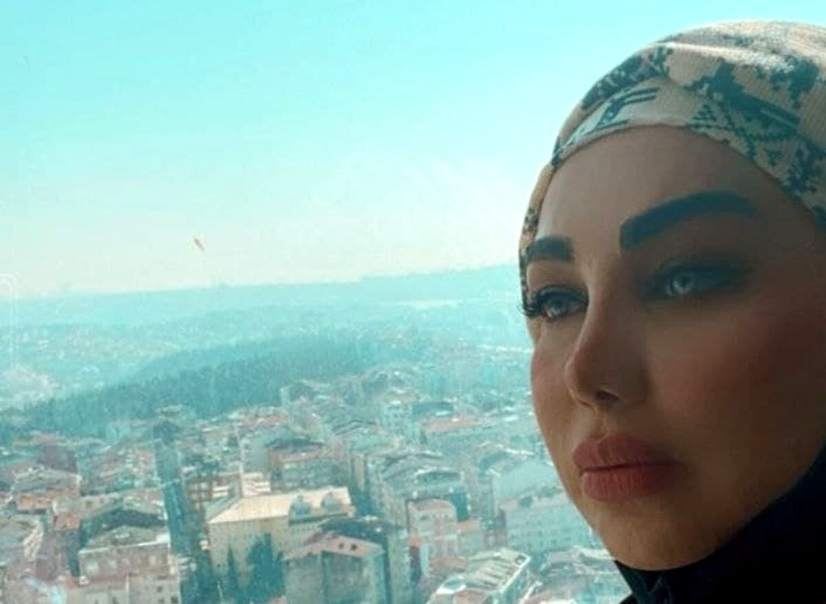 عکس جنجالی بهنوش بختیاری با دماغ قبل از عمل!!!+عکس