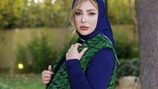 صورت زخم و کبود نیوشا ضیغمی