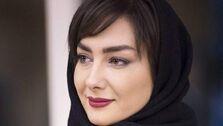 عکس هانیه توسلی قبل از عمل زیبایی+عکس دیده نشده 