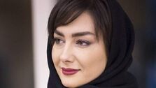 عکس هانیه توسلی قبل از عمل زیبایی+عکس دیده نشده 