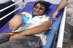 حمله خونین به 2 بازیگر معروف تلویزیون! +عکس