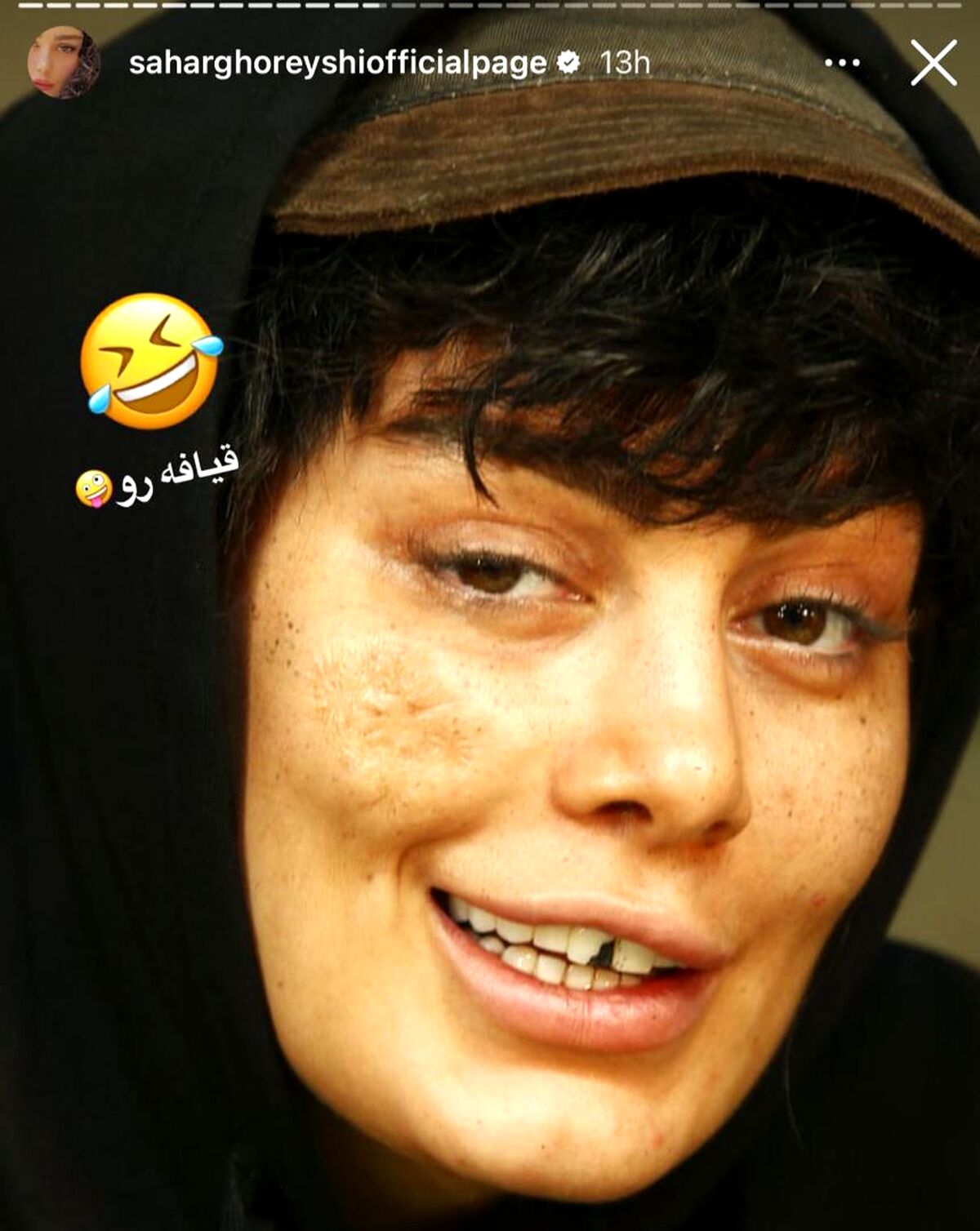عکس لو رفته از چهره داغون و شکسته سحر قریشی همه رو شوکه کرد