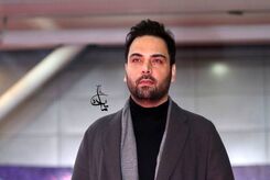 چهره قبل از عمل احسان علیخانی سوژه شد! +تصاویر باورنکردنی