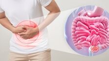 با این روش خانگی یبوست را سریع درمان کنید+راهکار