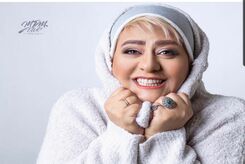 تغییر چهره قابل توجه رابعه اسکویی+عکس