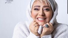 تغییر چهره قابل توجه رابعه اسکویی+عکس