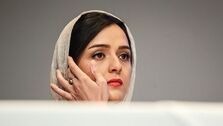عکسی تعجب‌آور از تغییر ظاهر ترانه علیدوستی!